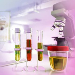 URINE TESTS